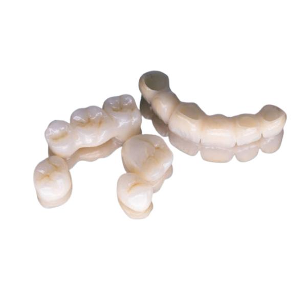 Лаборатория Denture аппаратуры восстановления фарфора высокой точности зубоврачебная