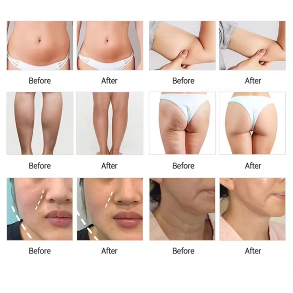 Endermology LPG  Roller Massage 360 Rotation Roller Reduction Vacuum Suction Body Slimming Equipment Beauty Machine