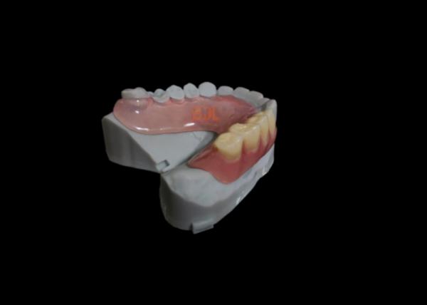 No Metal Showing Hypoallergenic Flexible Partial Denture with 3-Day Turnaround for Comfortable Dental Restoration