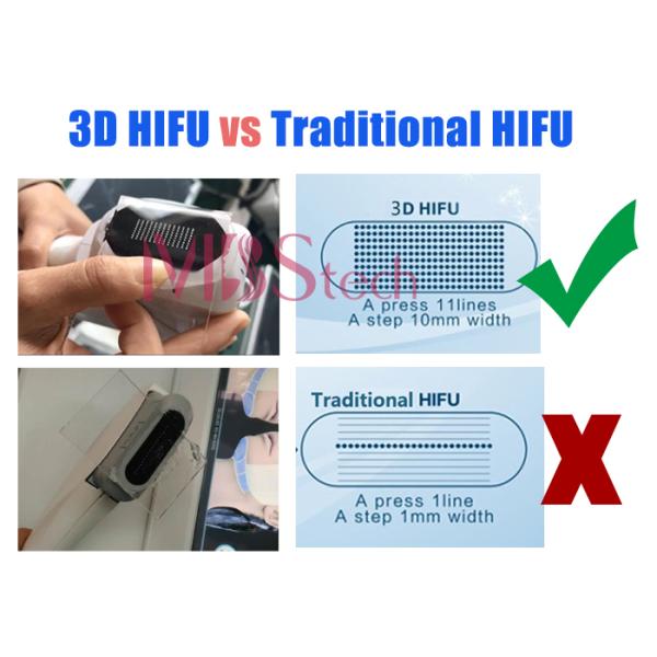 Cuerpo facial del balneario de la belleza que levanta 12 líneas máquina de 3D HIFU RF