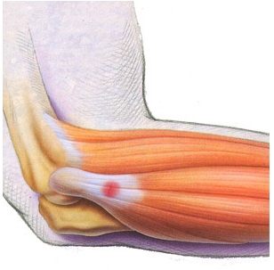 Pain Relief ESWT Shockwave Therapy Machine Smartwave Tennis Elbow Treatment