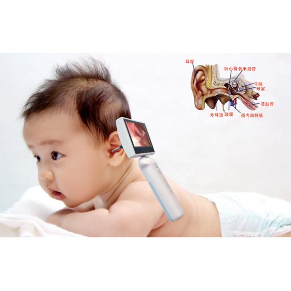 Ear Otoscope Digital Video Otoscope Camera Otoscope Set Ear Endoscope