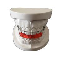 Les orthodonties faites sur commande de positionneur de dent d'OEM simples installent facile maintiennent