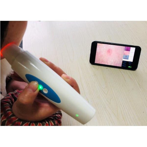 Handheld Digital Skin Analyzer 50 Times Lense For Skin And 200 Times Lense For Scalp