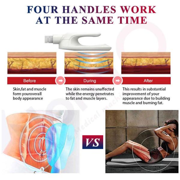 здание мышцы машины HIEMT нео RF тела 5000W Emslim ваяя