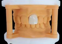 Coroa dental de zircônio translúcido com desempenho estético do laboratório dentário da China