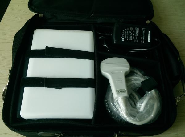 Transvaginal Handheld Ultrasound Scanner With 5 Kinds Of Probe Heads Exchangeable