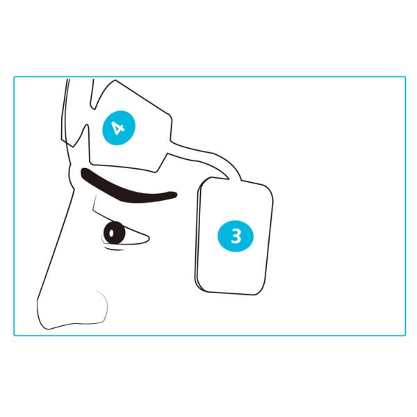 Disposable Eeg Brain Wave Sensor Non Invasive Forehead Adhesive 4 Electrodes With BIS Monitoring