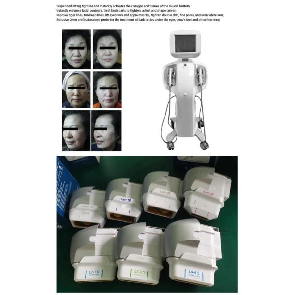 The Latest Korea Technology 7d HIFU 30000 shots Facial Lift Anti-wrinkle machine