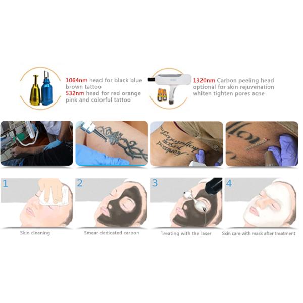 MINI usine portative Offter direct 1064 d'utilisation de maison de style 532 retrait de tatouage de laser de ND YAG de commutateur de 1320nm Q