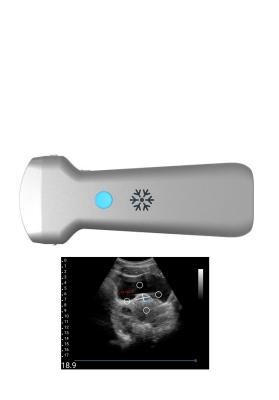 Ultrasonication Convex Wireless Ultrasound Probe For Gynecology