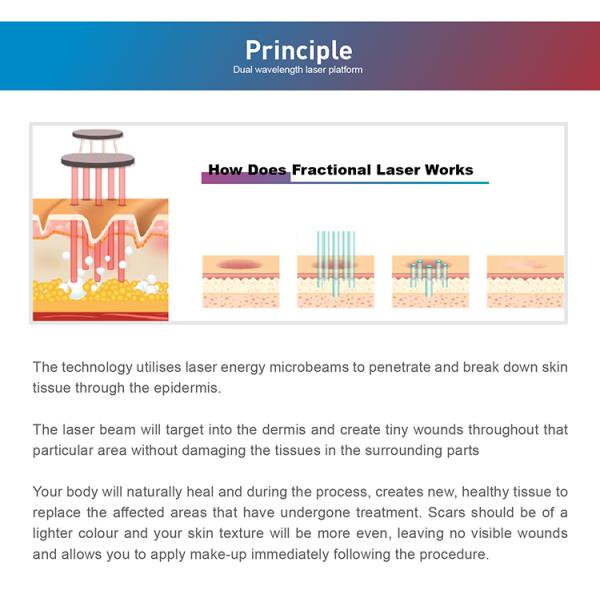 Профессиональная 60 Вт RF трубка Q-свича фотона фракционный CO2 лазерная машина для восстановления кожи