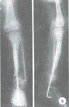 X Ray médico seco impermeável filma Konida lustroso para AGFA/Fuji