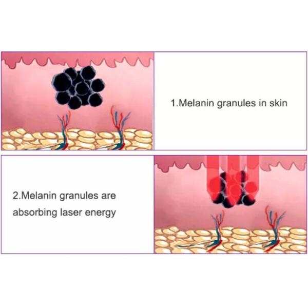 Pulse Width 8ns 1000W Q Switch ND YAG Laser Machine