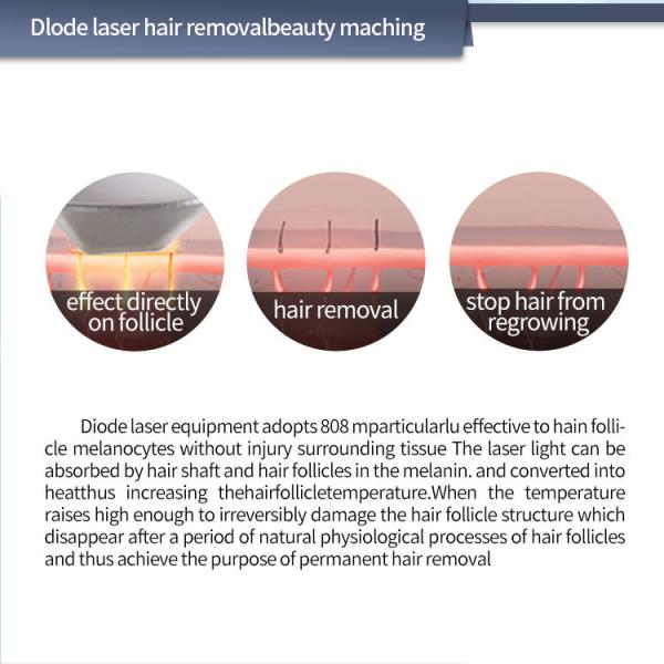 10.4 Inch 808nm Diode Laser Hair Removal Device Triple Wavelength Skin Rejuvenation