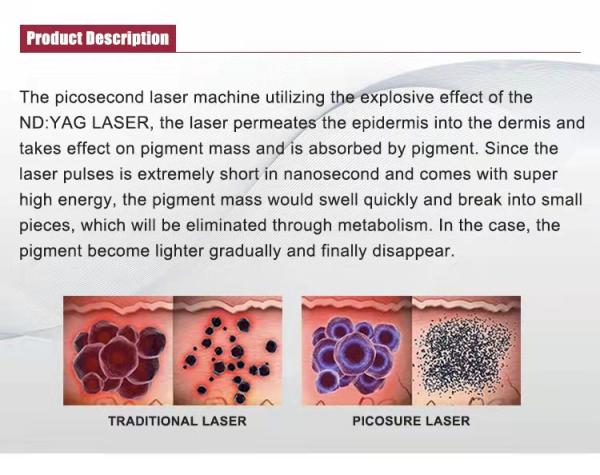 Portable 755nm Picolaser Tatoo Remover Q Switch Nd Yag Picosecond Laser Tattoo Removal Machine