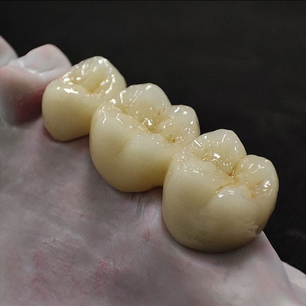 Zirconia Crown Bridge Dental Laboratory China High Accuracy CE FDA ISO Standard