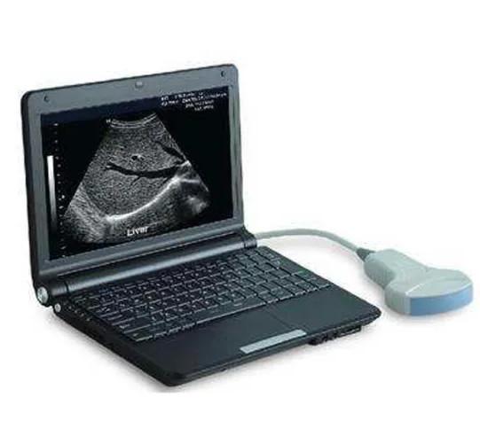 2.5-8.5MHz Diagnostic Ultrasound Equipment / 256 Levels Tablet Ultrasound Machine