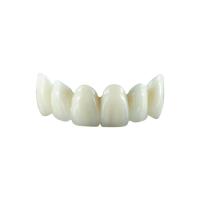 Coroa natural do dente da zircônia da cor menos os molares transparentes nenhumas linhas pretas nas bordas