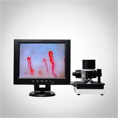 Microscópio clínico do Microcirculation da análise do sangue da máquina do analisador da saúde da exposição do LCD