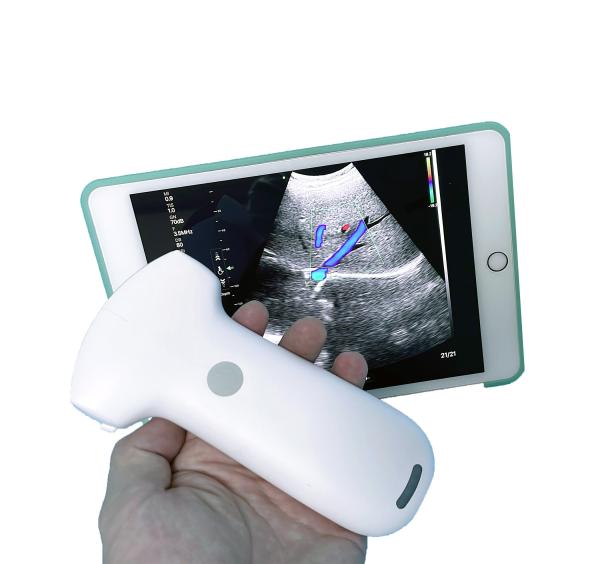 Affordable Ultrasound Equipment Wireless Convex Array Medical Probe MSLPU94