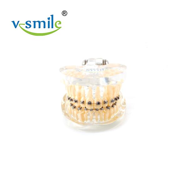 Oral Orthodontics Stainless Steel Self Ligating Brackets 0.022'' 0.018''