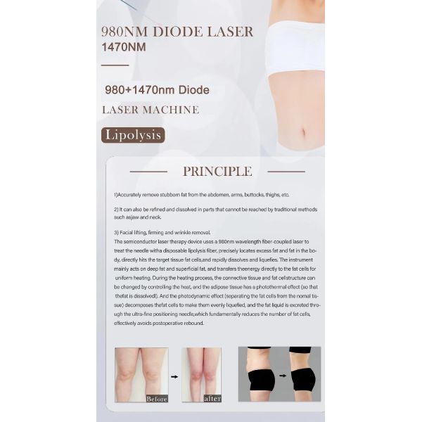 Lipolysis Liposuction 980 1470nm Diode Laser Machine Skin Rejuvenation