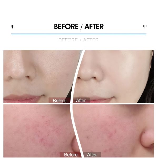 LED Facial And Scalp Therapy Machine For Skin Rejuvenation Collagen Boost / Hair Regrowth