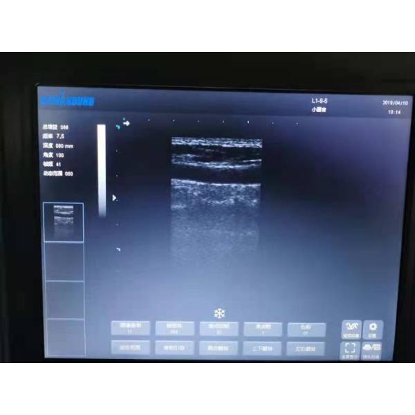 Hospital Outside Diagnostic Linear Ultrasound Machine Dog Ultrasound Machine Laptop Cow Pregnancy Sheep Scanner