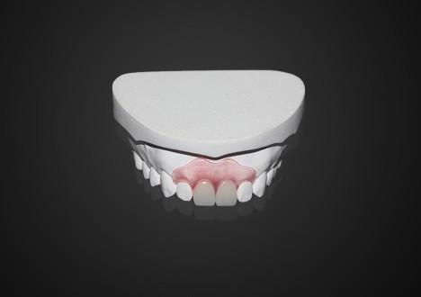 Lightweight Comfortable Valplast Partial Denture Easy Cleaning High Transparency