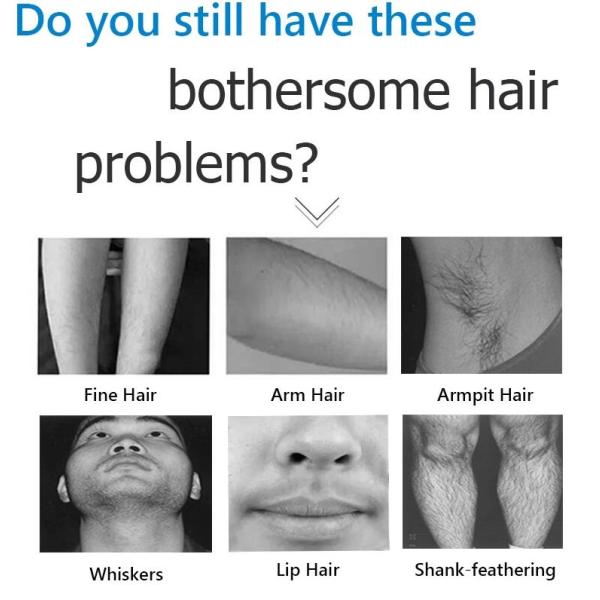 Professional SHR Hair Removal Machine , E - Light IPL Beauty Machine