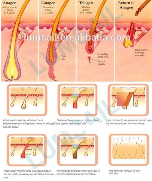 Touch Cooling IPL Laser Hair Removal Machine / Skin Rejunvation Machine Painless