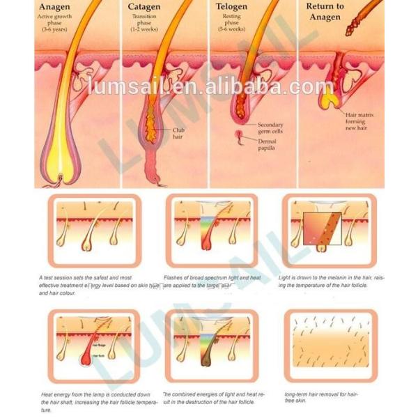 Касайтесь охлаждая машине удаления волос лазера ИПЛ/машине Реджунватион кожи безболезненным