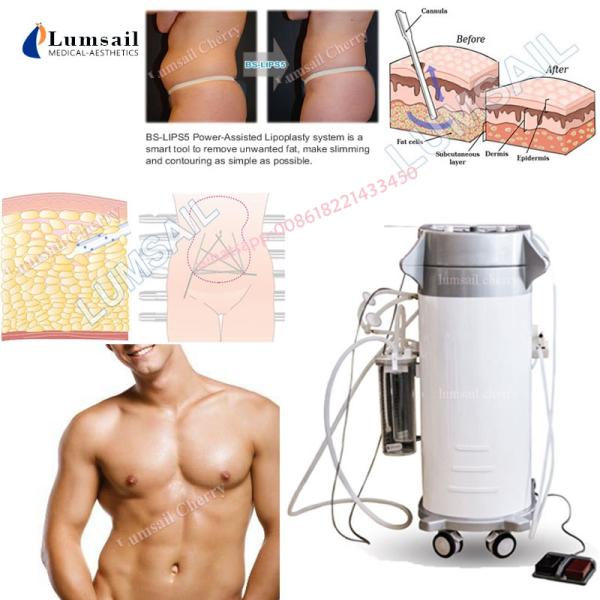 Fat Removal Surgical Liposuction Machine Weight Loss Cavitation Vacuum Liposuction