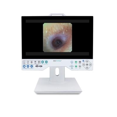 15 Inch FHD Camera System Compatible Flexible And Rigid Endoscope Professional Manufacturer