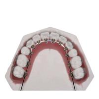 Le fil droit a fixé les appareils orthodontiques pour le redressage de dents