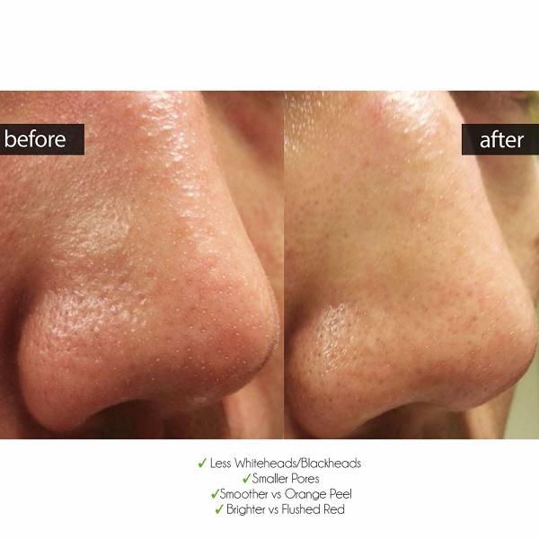 Все естественное разводя водой поглощение вулканического лицевого щитка гермошлема грязи супер для маслообразной кожи