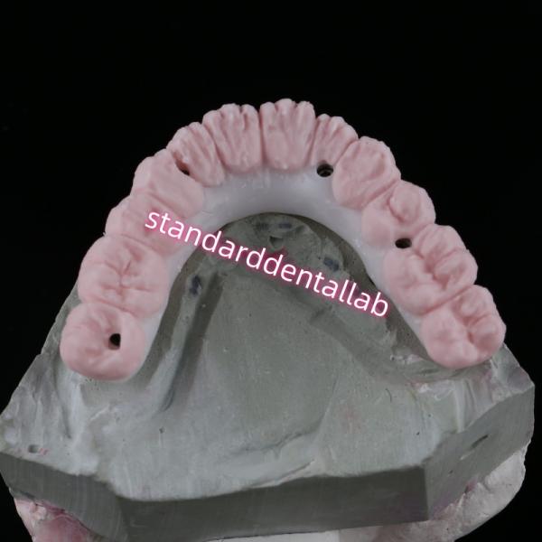 Porcelain All On Four Zirconia Bridge High Esthetics Dental Implant Bridge