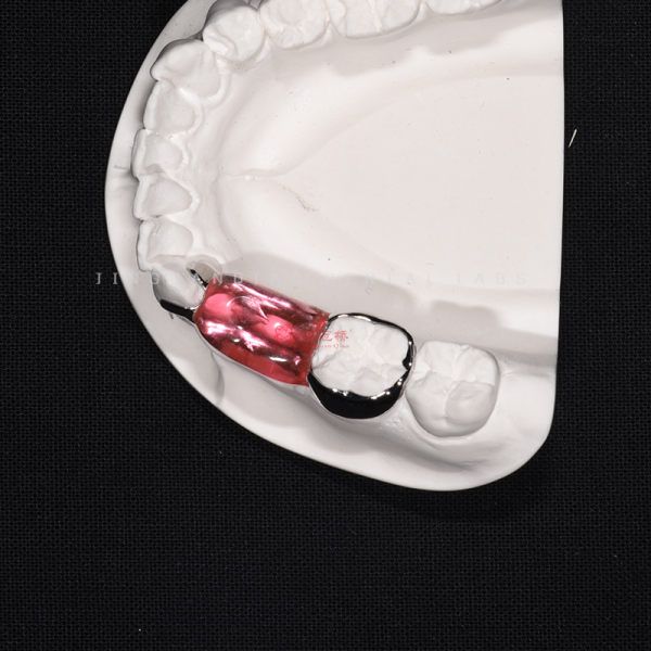 Customized Anti Snoring Guard Space Maintainer For Dentistry Prosthesis