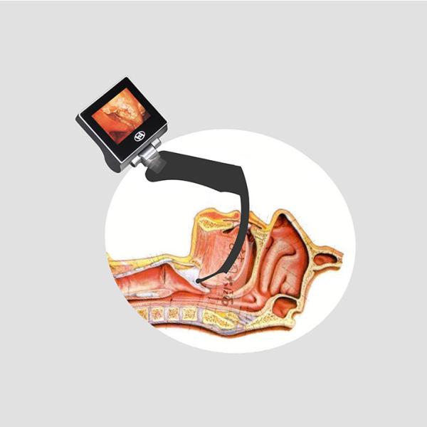 CMOS Intubation Handheld Video Laryngoscope With 70 Degree Hyperangulated Glottis Visualization