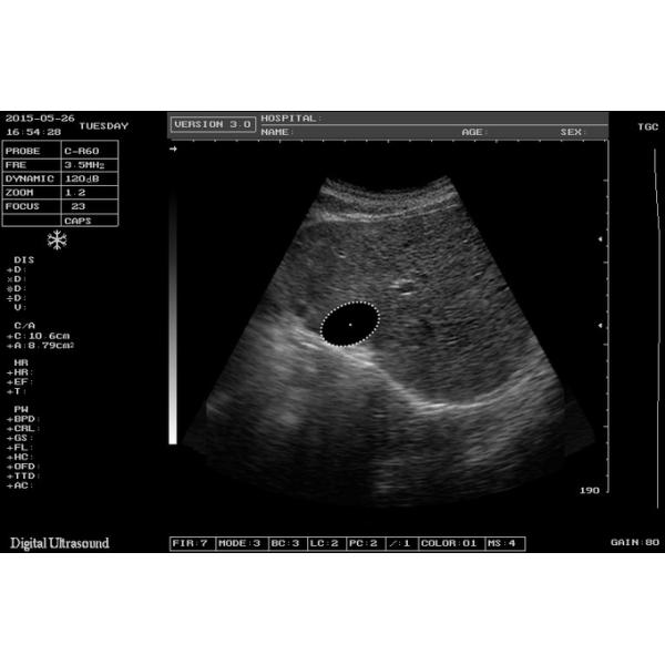 Машина развертки тетради USG развертки электрона ISO для акушерства и Gynecology