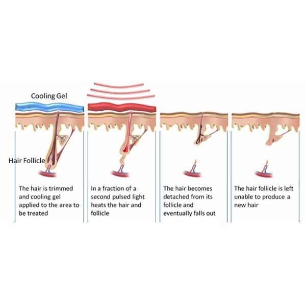 Vascular Treatment Laser Hair Removal Equipment , Ipl Hair Removal System Painless Mode