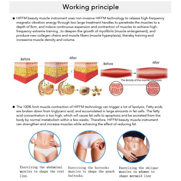 Замораживание Cryolipolysis жирного удаления жирное уменьшая ваять тела EMS Cryo машины