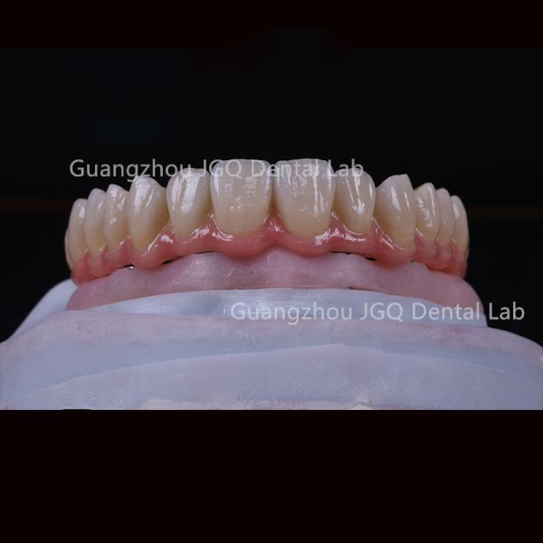 All On 6 Dental Implants Fixed Dentures Dental Lab All Ceramic FDA CE Certificated