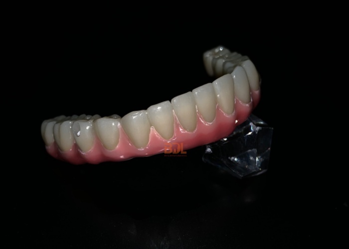 Durable Dental Implant Support Bar Featuring Superior Mechanical Properties for Effective Dental Prosthesis Integration