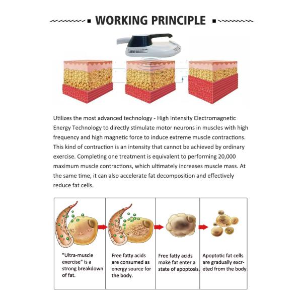 Cuerpo del estimulador del músculo de 4 manijas el ccsme Tesla que adelgaza el sistema de refrigeración por aire de la máquina