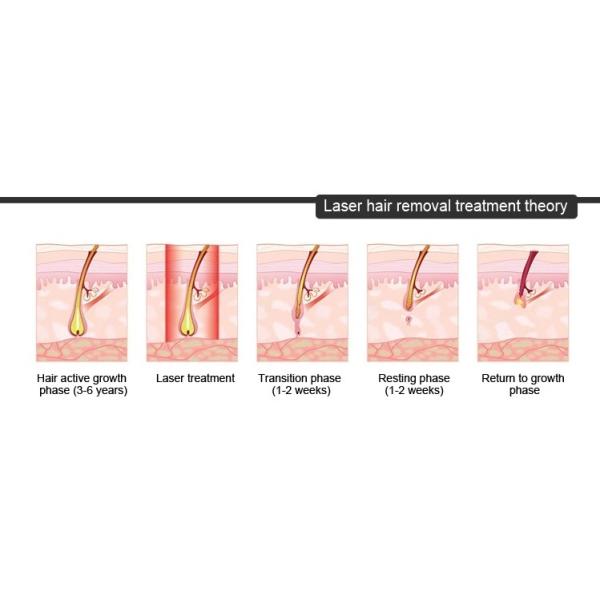 Mic Channel 4d 755 808 1064nm Diode Laser Hair Removal Machine