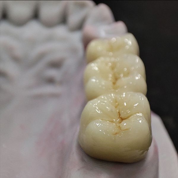 CE Certified Zirconia Dental Crown with 3D Laser Printing and Customized Design