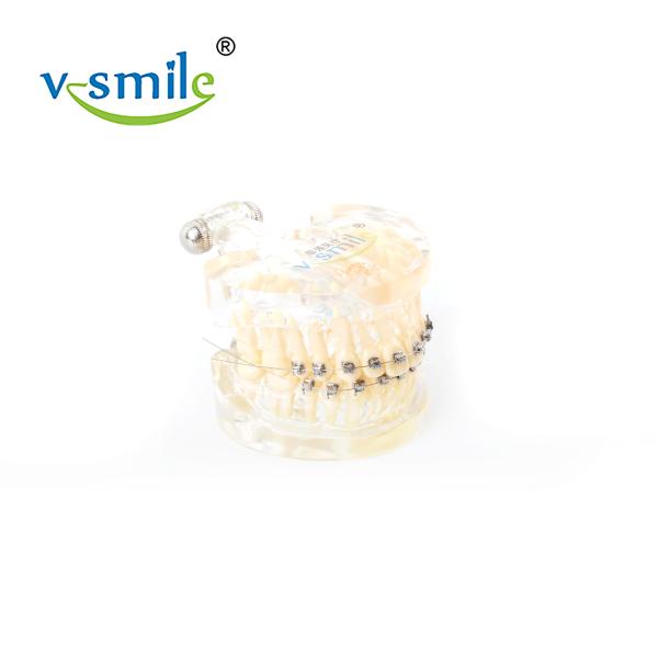 Oral Orthodontics Stainless Steel Self Ligating Brackets 0.022'' 0.018''