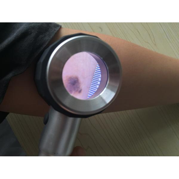 Увеличитель высокой точности оптически кожа Analyer Dermatoscope 10 времен используя 2 * объектив оптически стекла металла батарей AA No.5